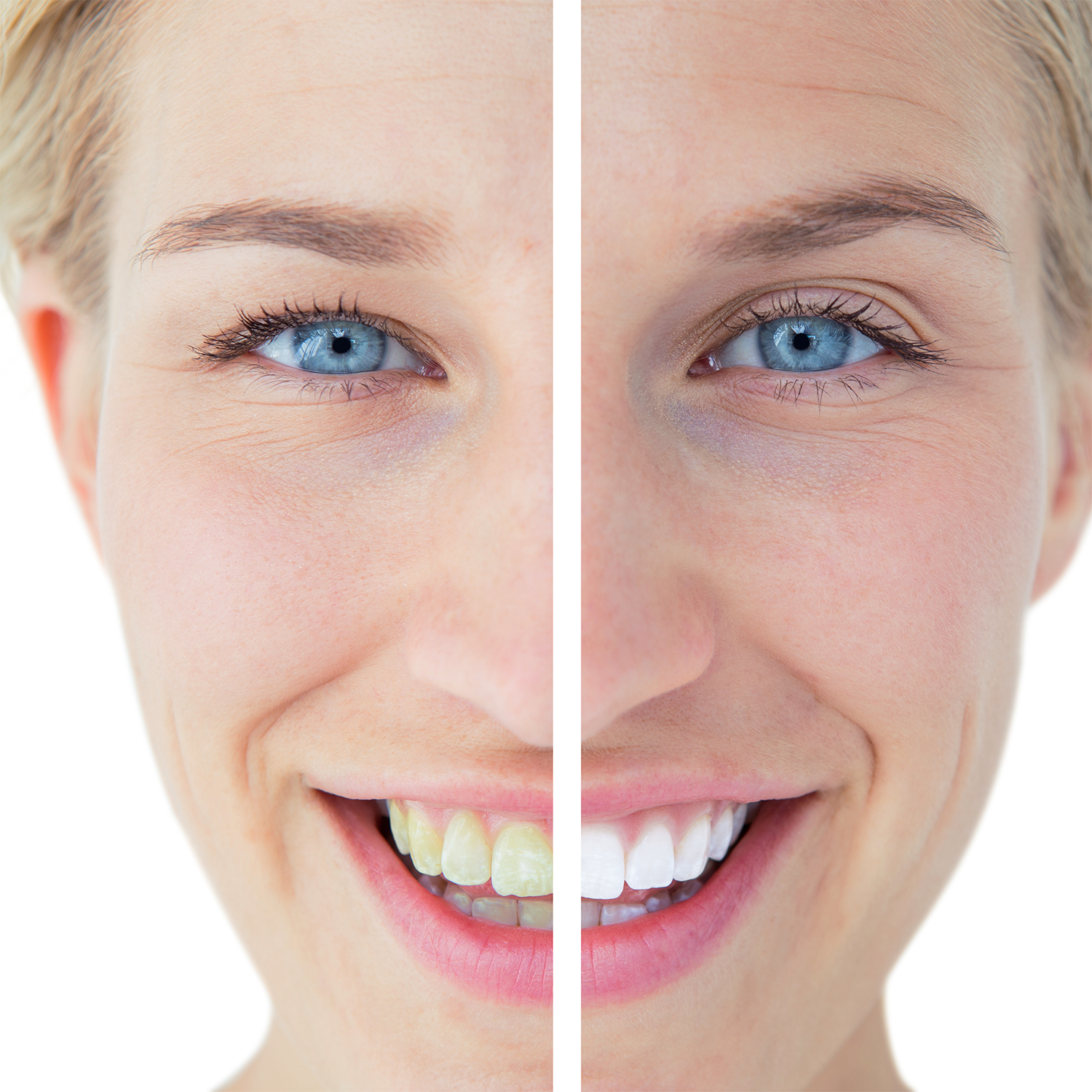 4 Opzetborstels voor AG350